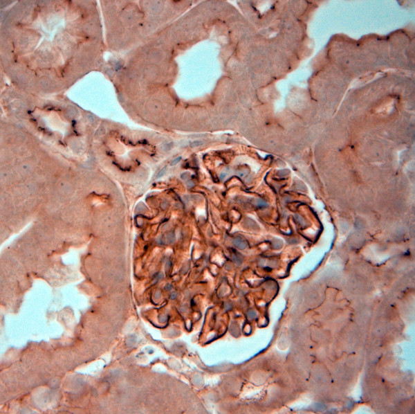 ZO1 Antibody in Immunohistochemistry (Paraffin) (IHC (P))