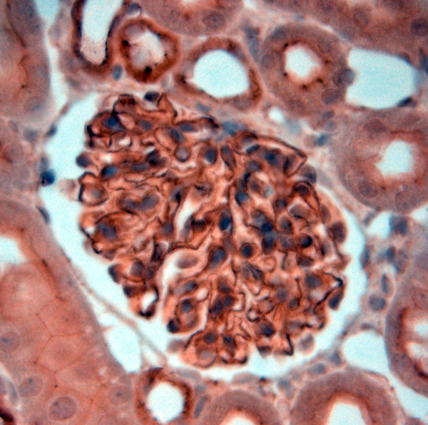 ZO1 Antibody in Immunohistochemistry (Paraffin) (IHC (P))