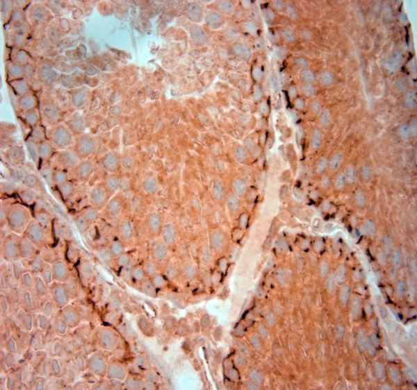 ZO1 Antibody in Immunohistochemistry (Paraffin) (IHC (P))