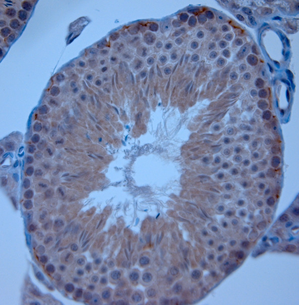 ZO1 Antibody in Immunohistochemistry (Paraffin) (IHC (P))