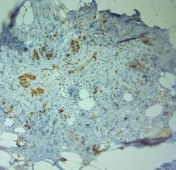 ZO2 Antibody in Immunohistochemistry (Paraffin) (IHC (P))