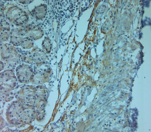 ZO2 Antibody in Immunohistochemistry (Paraffin) (IHC (P))