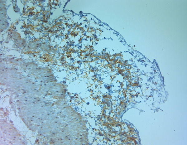 ZO2 Antibody in Immunohistochemistry (Paraffin) (IHC (P))