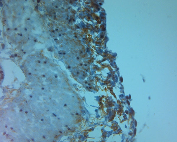 ZO2 Antibody in Immunohistochemistry (Paraffin) (IHC (P))