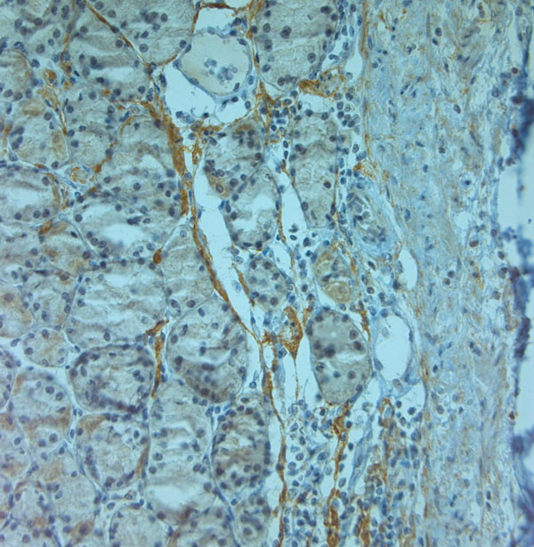 ZO2 Antibody in Immunohistochemistry (Paraffin) (IHC (P))