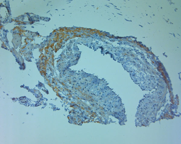 ZO2 Antibody in Immunohistochemistry (Paraffin) (IHC (P))