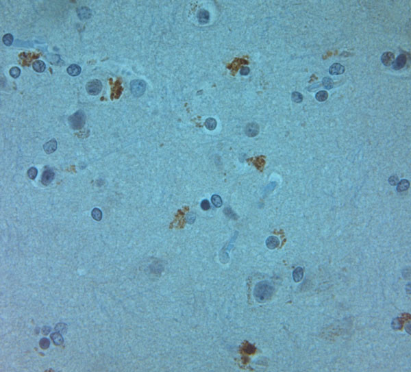 ZO2 Antibody in Immunohistochemistry (Paraffin) (IHC (P))