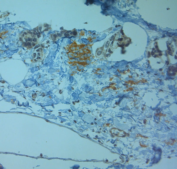 ZO2 Antibody in Immunohistochemistry (Paraffin) (IHC (P))