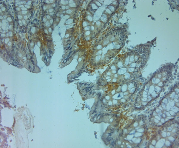 ZO2 Antibody in Immunohistochemistry (Paraffin) (IHC (P))