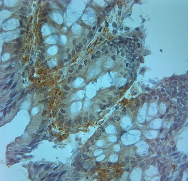 ZO2 Antibody in Immunohistochemistry (Paraffin) (IHC (P))