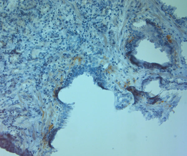 ZO2 Antibody in Immunohistochemistry (Paraffin) (IHC (P))