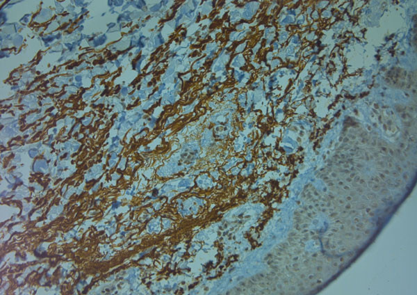 ZO2 Antibody in Immunohistochemistry (Paraffin) (IHC (P))