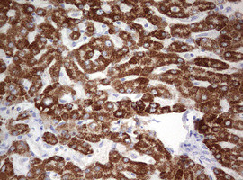 OTC Antibody in Immunohistochemistry (Paraffin) (IHC (P))