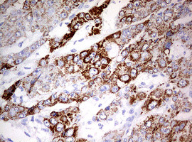 OTC Antibody in Immunohistochemistry (Paraffin) (IHC (P))