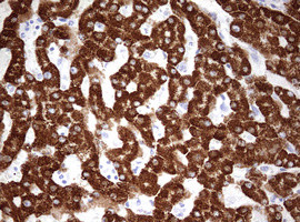 OTC Antibody in Immunohistochemistry (Paraffin) (IHC (P))