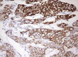 OTC Antibody in Immunohistochemistry (Paraffin) (IHC (P))