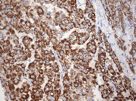 OTC Antibody in Immunohistochemistry (Paraffin) (IHC (P))