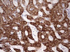 OTC Antibody in Immunohistochemistry (Paraffin) (IHC (P))