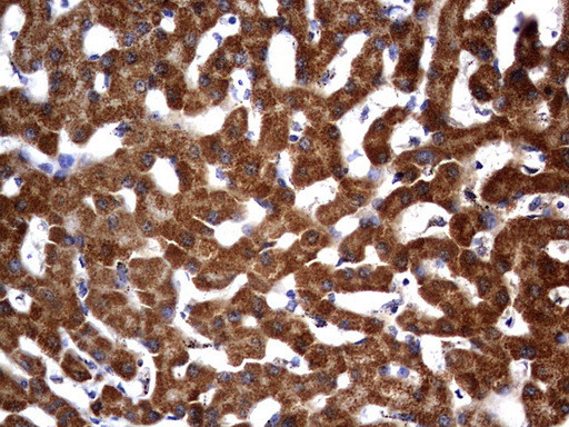 OTC Antibody in Immunohistochemistry (Paraffin) (IHC (P))