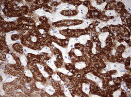 OTC Antibody in Immunohistochemistry (Paraffin) (IHC (P))