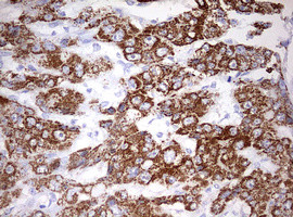 OTC Antibody in Immunohistochemistry (Paraffin) (IHC (P))