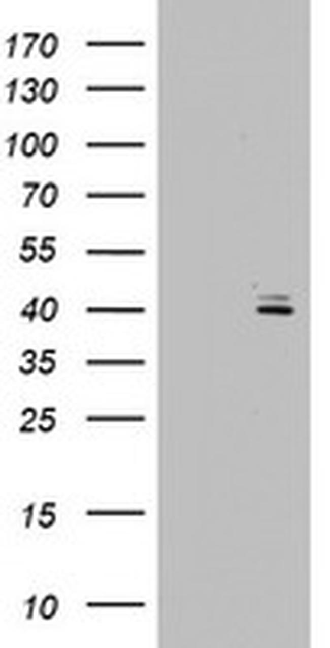 OTC Antibody in Western Blot (WB)