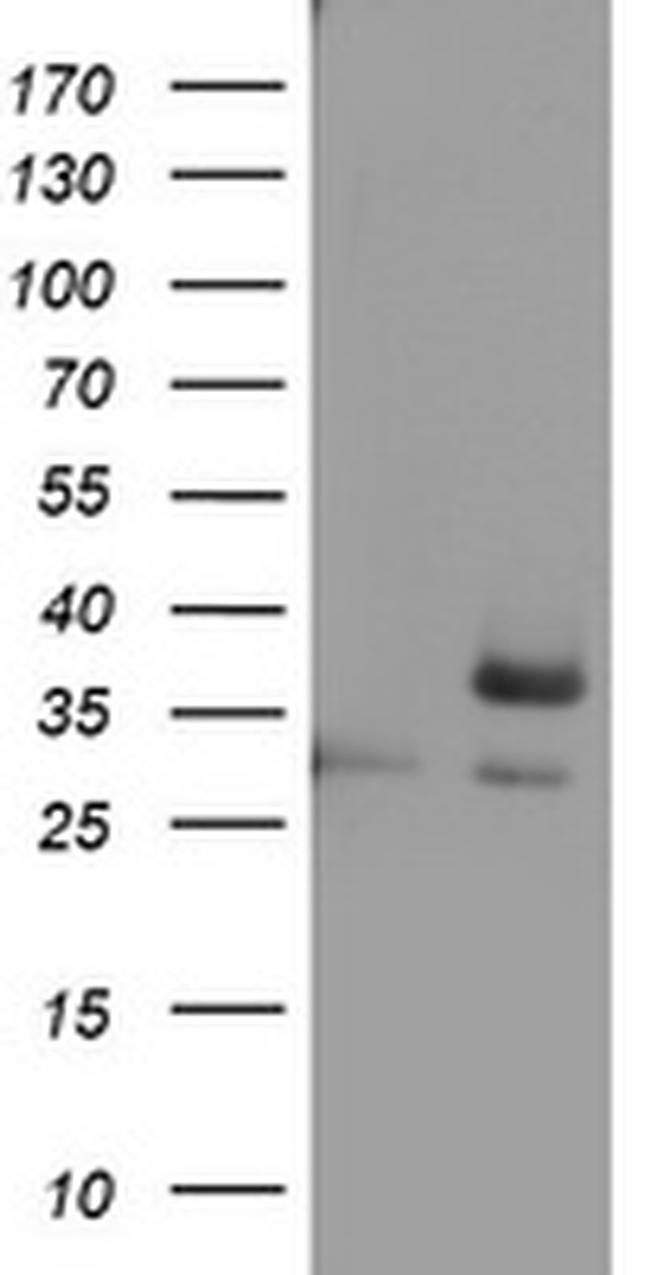 OTC Antibody in Western Blot (WB)