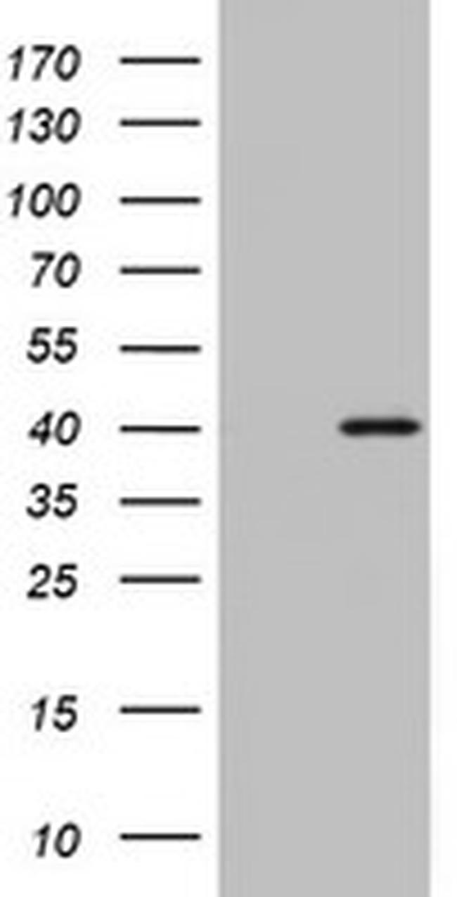 OTC Antibody in Western Blot (WB)