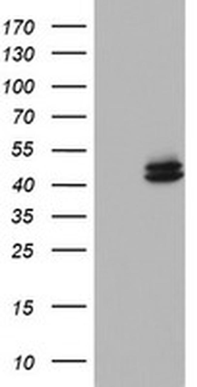 OTC Antibody in Western Blot (WB)