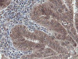 OTUB1 Antibody in Immunohistochemistry (Paraffin) (IHC (P))