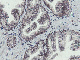 OTUB1 Antibody in Immunohistochemistry (Paraffin) (IHC (P))