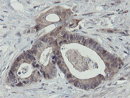 OTUB1 Antibody in Immunohistochemistry (Paraffin) (IHC (P))