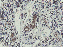 OTUB1 Antibody in Immunohistochemistry (Paraffin) (IHC (P))