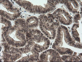 OTUB1 Antibody in Immunohistochemistry (Paraffin) (IHC (P))