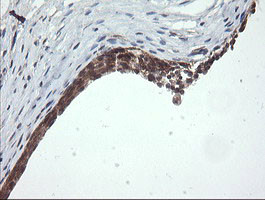 OTUB1 Antibody in Immunohistochemistry (Paraffin) (IHC (P))