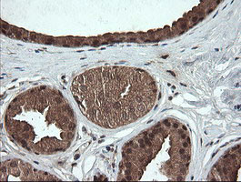 OTUB1 Antibody in Immunohistochemistry (Paraffin) (IHC (P))