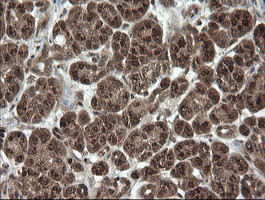 OTUB1 Antibody in Immunohistochemistry (Paraffin) (IHC (P))