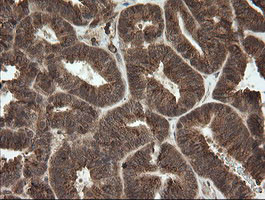 OTUB1 Antibody in Immunohistochemistry (Paraffin) (IHC (P))