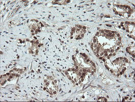 OTUB1 Antibody in Immunohistochemistry (Paraffin) (IHC (P))