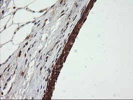 OTUB1 Antibody in Immunohistochemistry (Paraffin) (IHC (P))