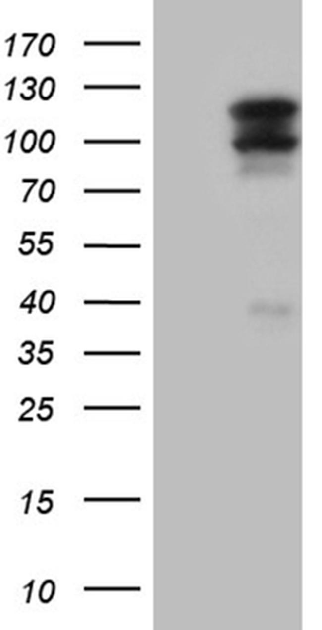 OTUD7B Antibody in Western Blot (WB)