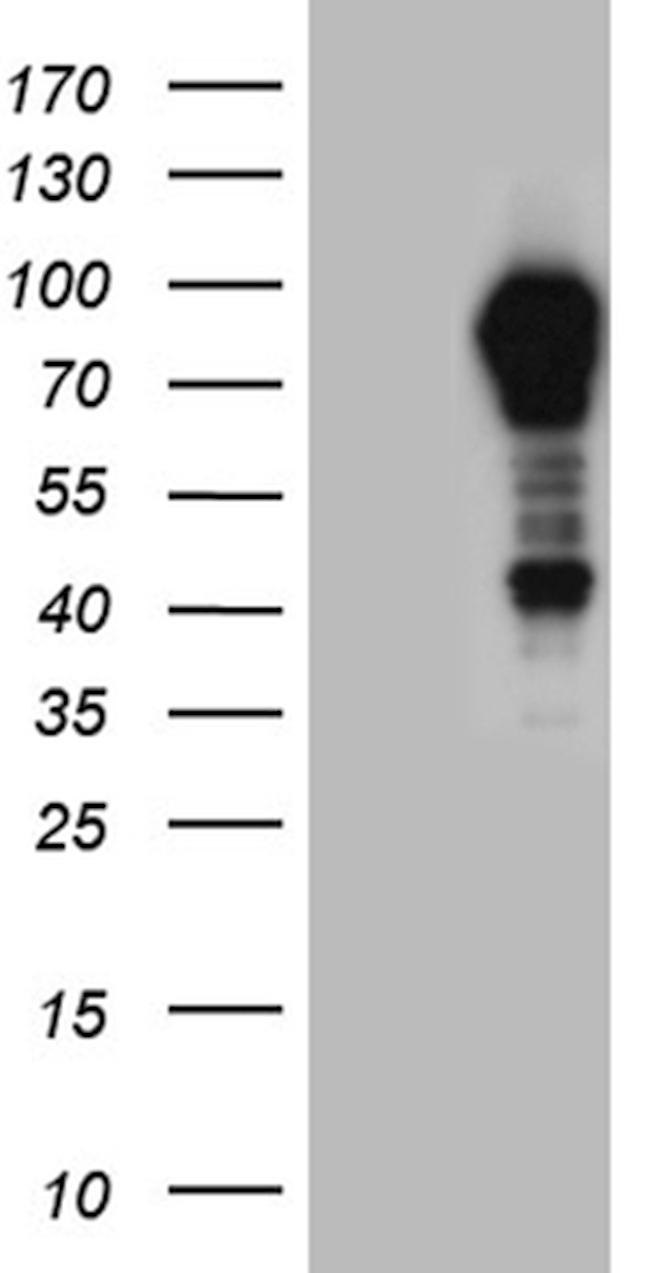 OTUD7B Antibody in Western Blot (WB)