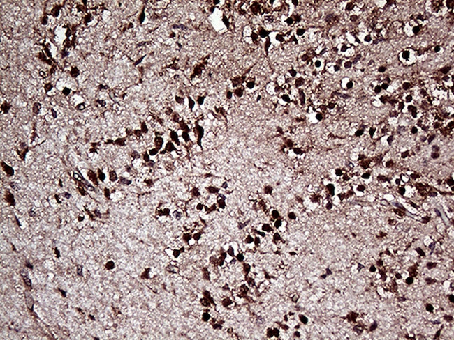 OTX2 Antibody in Immunohistochemistry (Paraffin) (IHC (P))