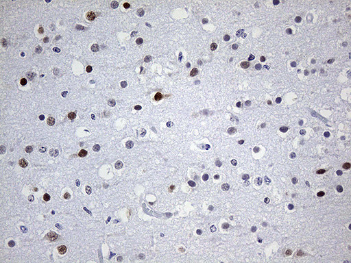 OTX2 Antibody in Immunohistochemistry (Paraffin) (IHC (P))