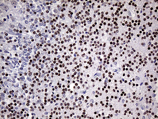 OTX2 Antibody in Immunohistochemistry (Paraffin) (IHC (P))