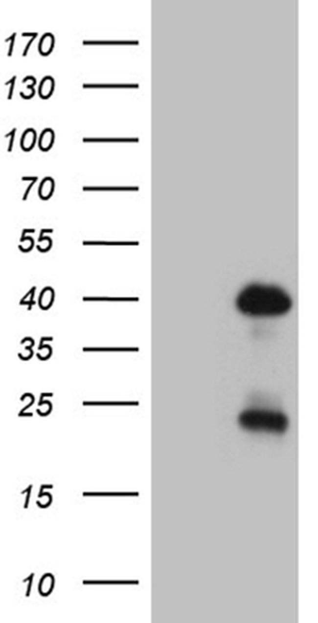 OTX2 Antibody in Western Blot (WB)