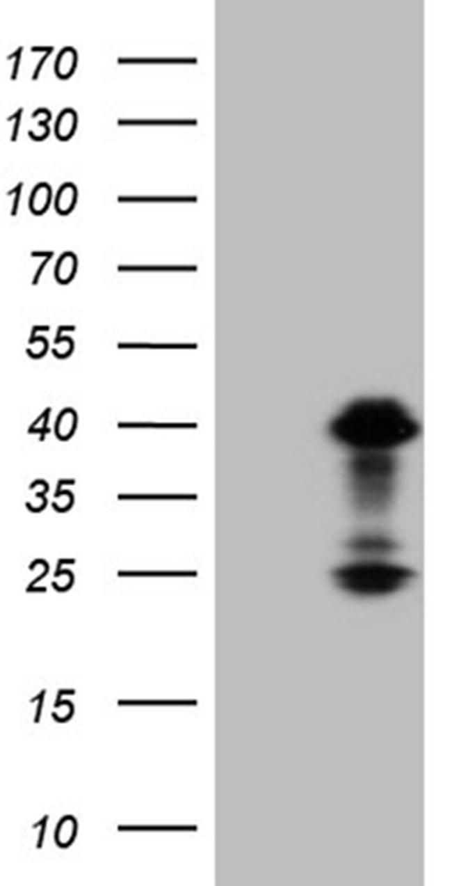 OTX2 Antibody in Western Blot (WB)