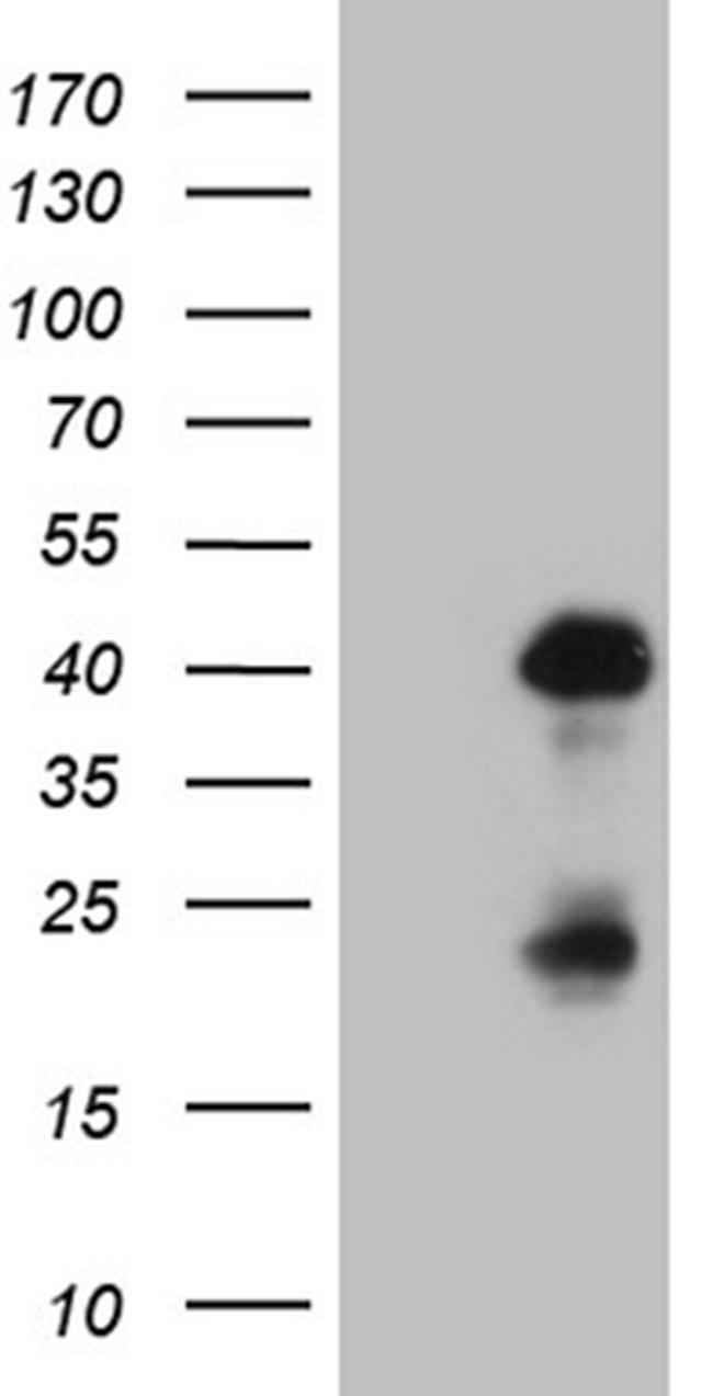 OTX2 Antibody in Western Blot (WB)