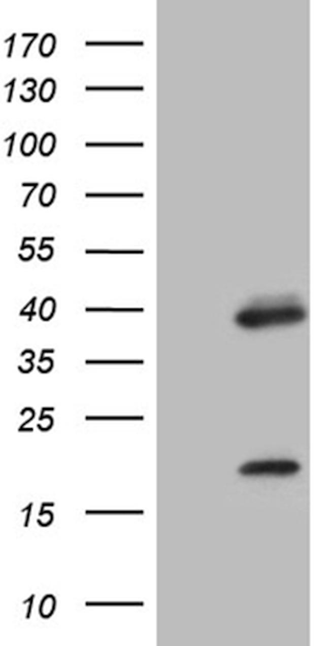 OTX2 Antibody in Western Blot (WB)