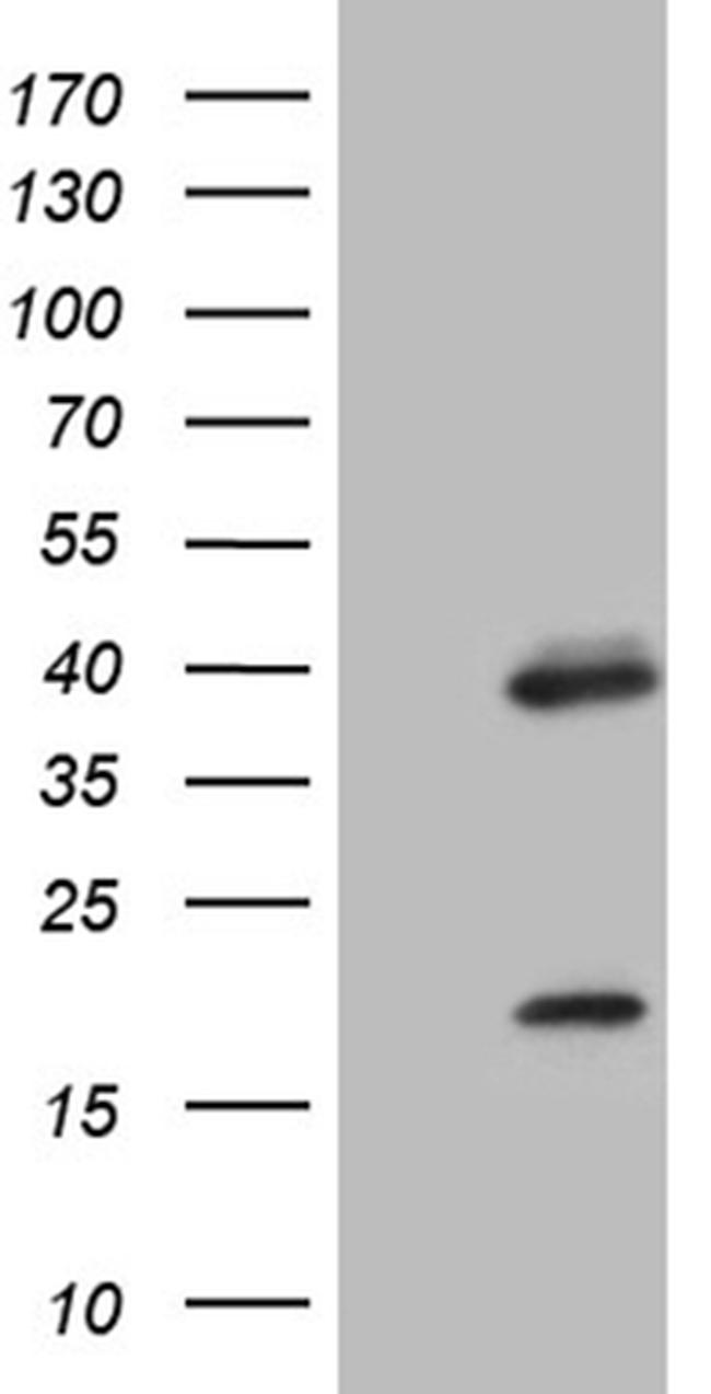 OTX2 Antibody in Western Blot (WB)